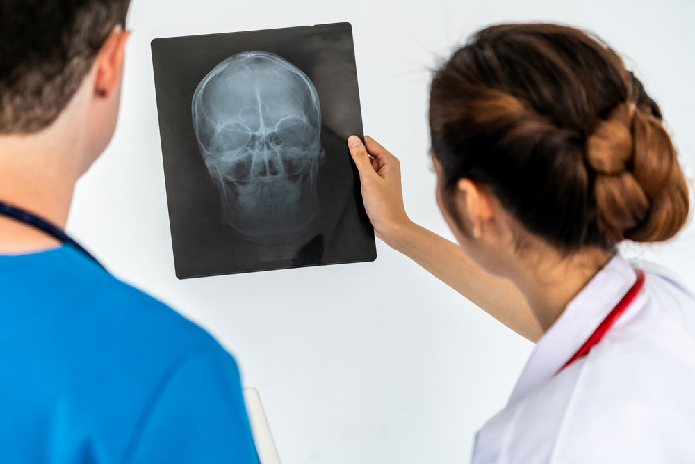 Doctors working with x-ray film of patient head